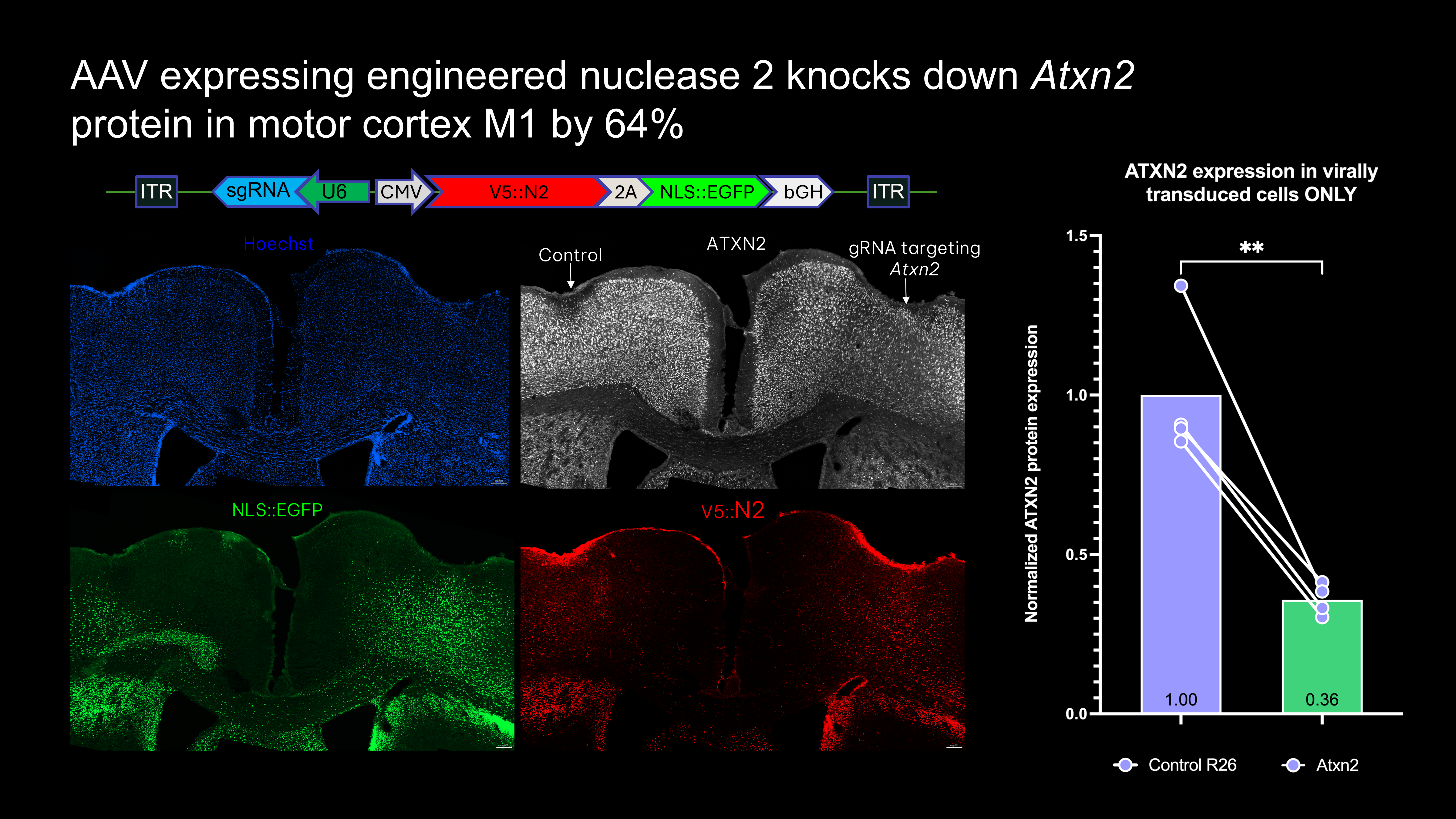 Dual injection coronal view 2